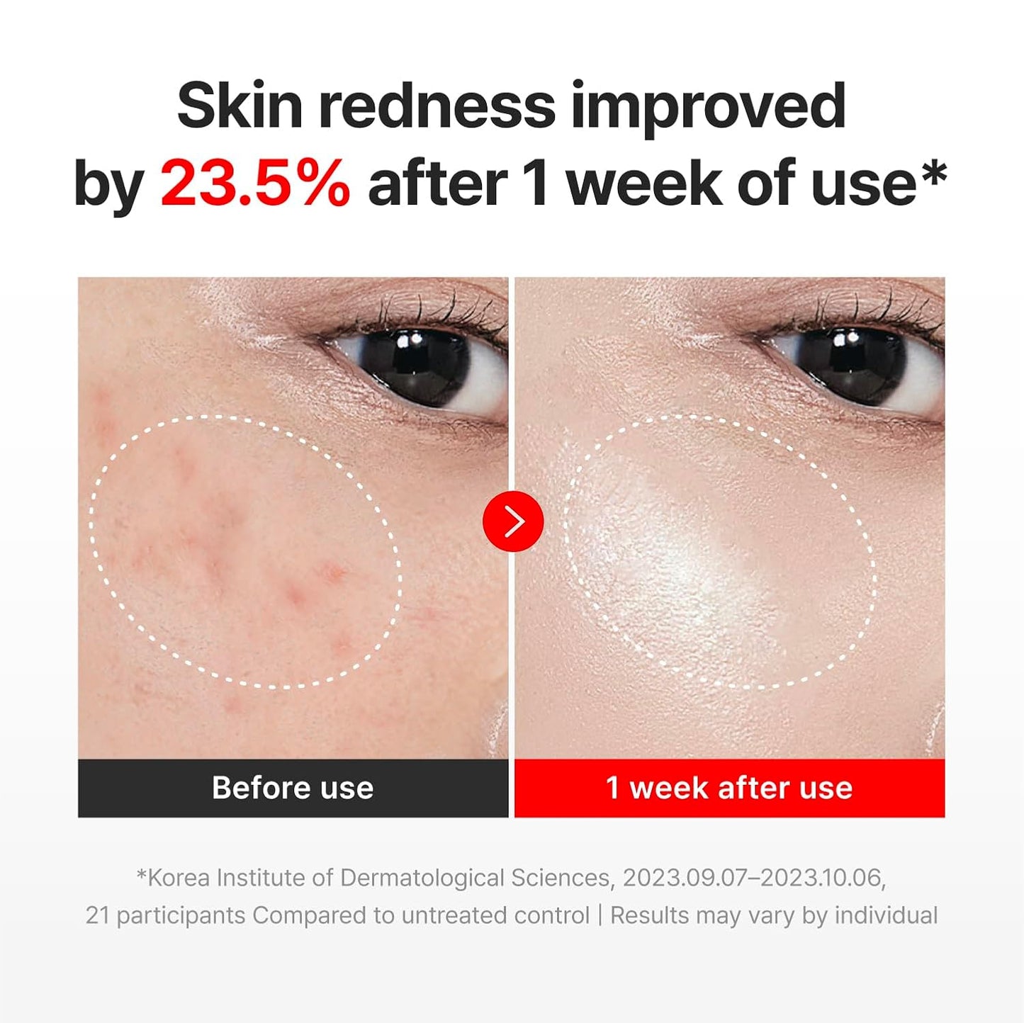 CENTELLIAN 24 Madeca Cream Time Reverse